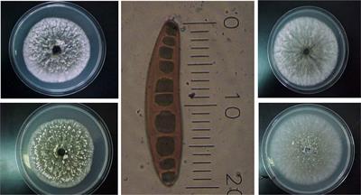helminthosporium sorokiniana)